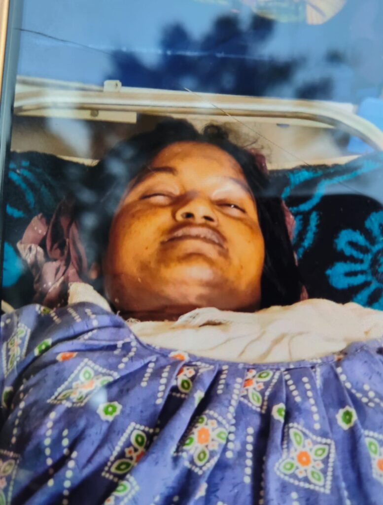 अलाव तापते समय साड़ी में लगी आग, नवविवाहिता की मौत